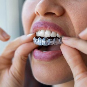 dental care alliance locations